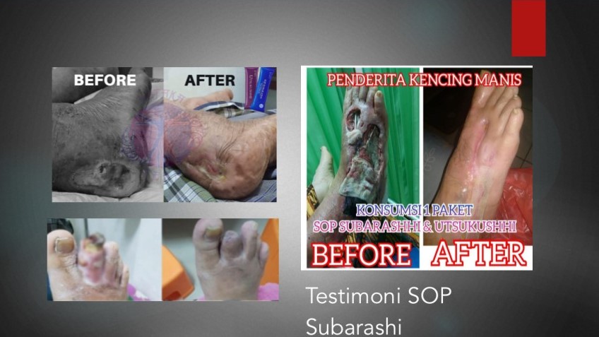 Testimoni SOP Subarashi (2) Testimoni SOP Subarashi (2)